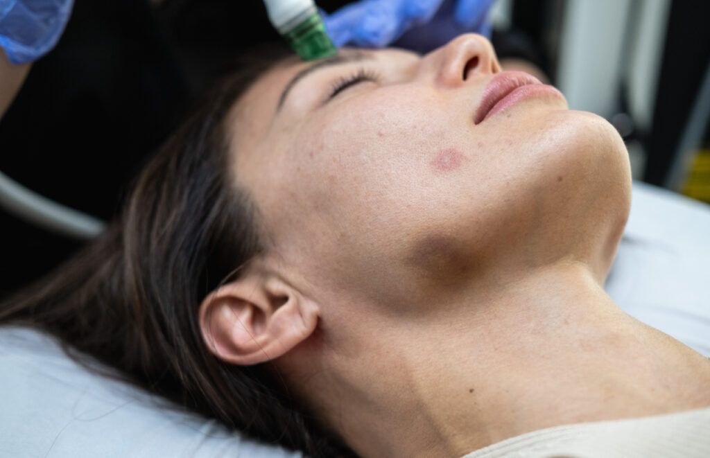 Cosmetic Surgery Injured Patient