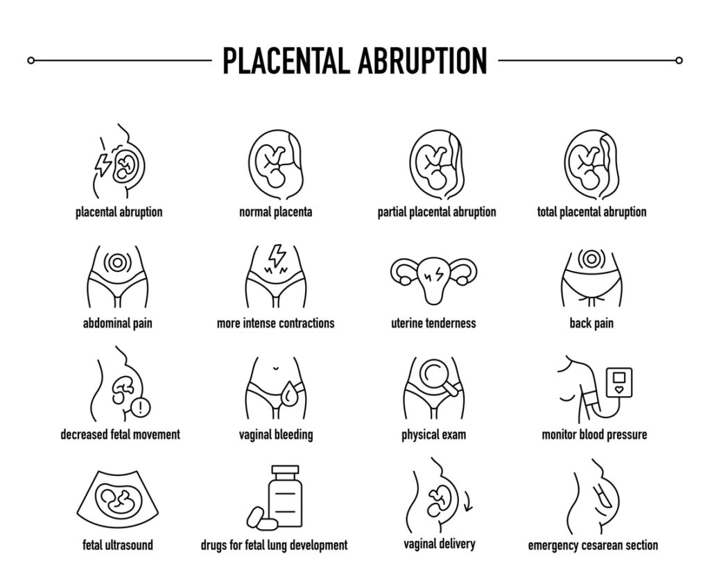 Placental Abruption vector icons

