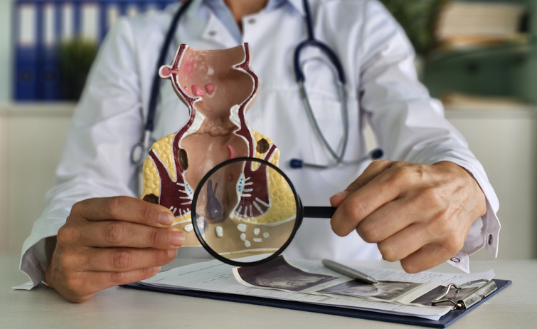 Colonoscopy Injury