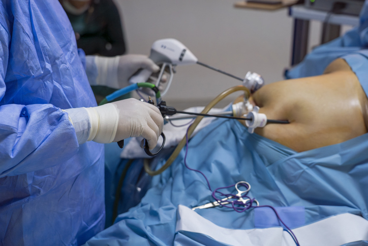 Gastric Bypass Injury