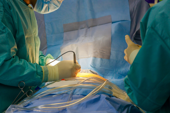 Nerve Injuries During Splenectomy Attorneys