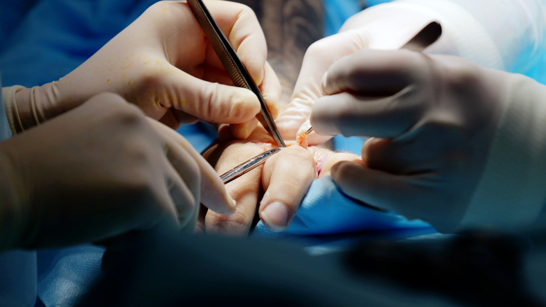 Nerve Injuries During Surgery