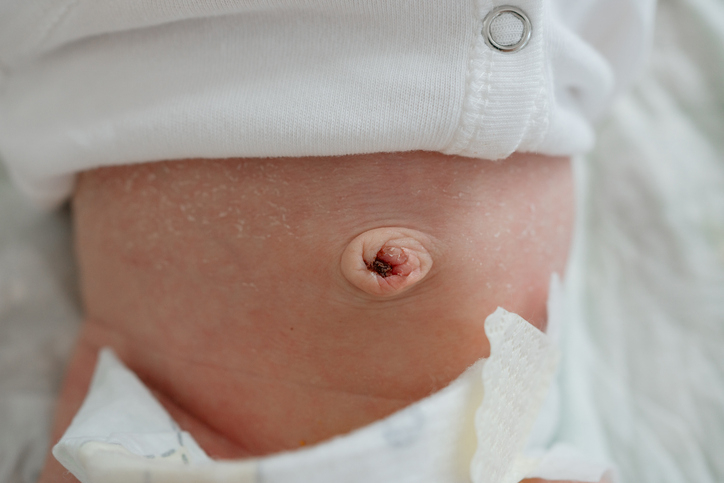 Prolapsed Umbilical Cord