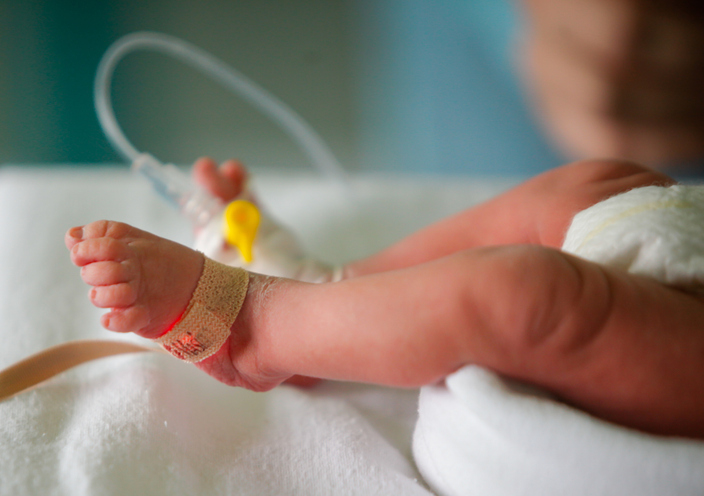 Vacuum Errors and Birth Injuries