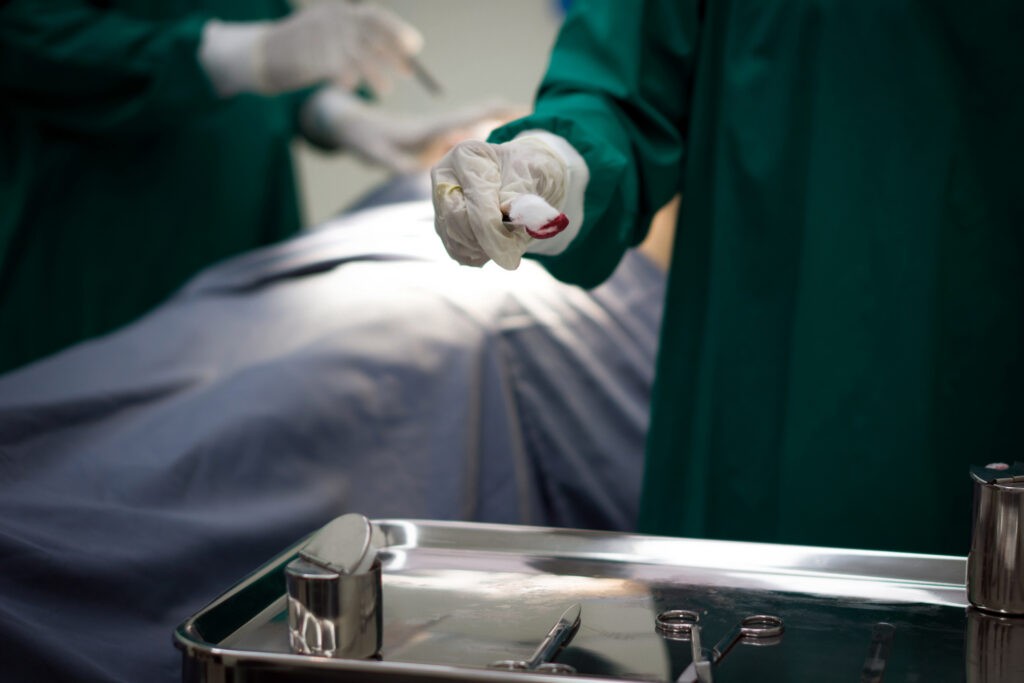 Serious Surgical Complications